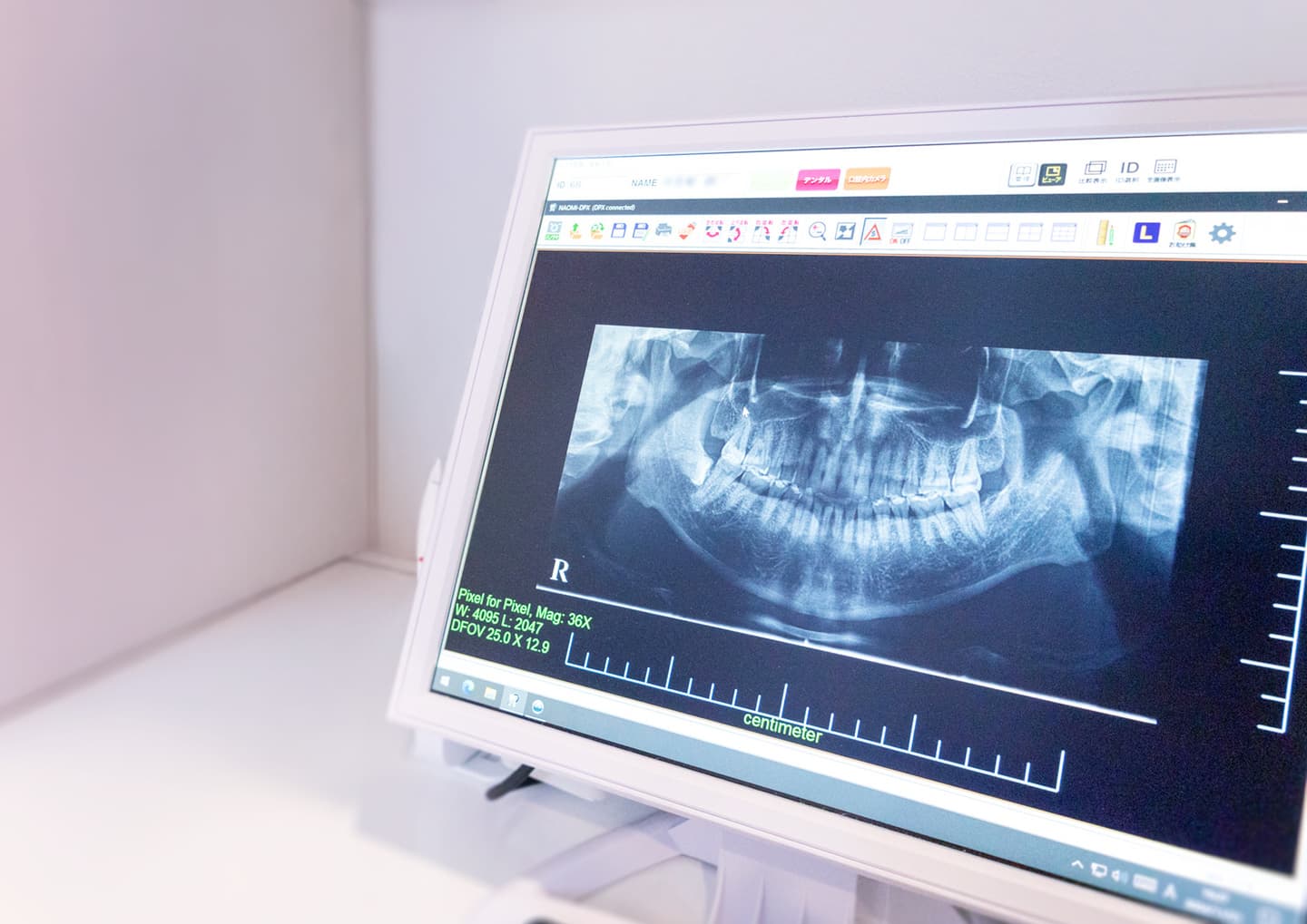 青山歯科医院 レントゲン 歯科用ディスプレイ